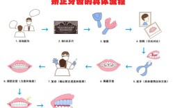 去医院矫正牙齿的流程