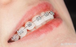 重庆哪里矫正牙齿好