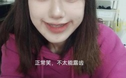 正畸牙弓变窄了