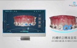正畸模型数字化管理
