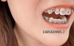 26岁还能牙齿矫正吗