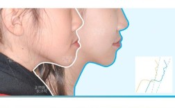 正畸颌面系统CMS系统的功能与应用是什么？