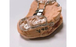 牙齿反合矫正器效果如何？适用哪些人群？