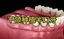 假牙可以新种牙吗