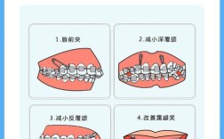 正畸支抗钉取钉疼吗？具体步骤和注意事项有哪些？