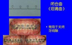 中国医科大口腔正畸学有何独特技术优势？