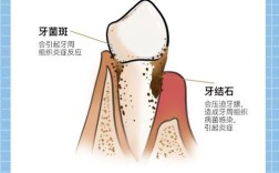 种牙前必须洗牙吗？术前口腔清洁的必要性是什么？