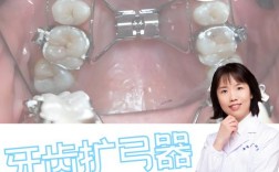 16岁矫正牙齿，整个过程一般需要多长时间完成？