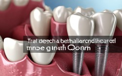 支抗钉真能代替种植牙？最新效果靠谱吗？