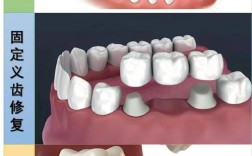 活动义齿调磨方法有哪些实用步骤？