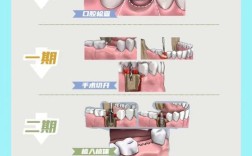 种牙算成活的具体判断标准有哪些？