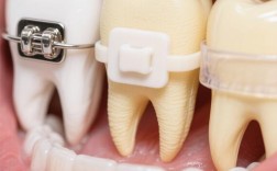 昆山牙齿矫正哪里好