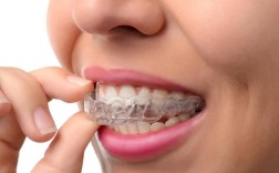 矫正牙齿能不戴牙套？替代方式有哪些？