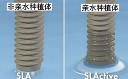 种牙为啥不建议亲水植体