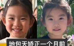 天包地矫正效果图能反映真实矫正效果吗？