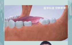 种牙需要骨粉吗