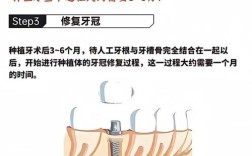 种植牙能矫正牙齿吗？