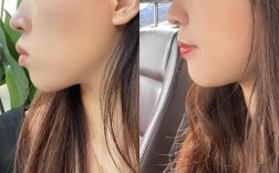 正畸牙齿矫正真的能让鼻梁变高吗？背后的原因、真实效果及科学依据是什么？