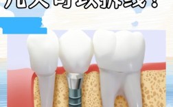 种牙需要拆线么