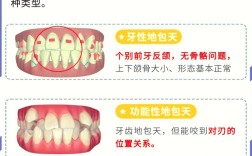 地包天矫正几岁开始最合适？最佳年龄是多少岁？