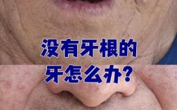 牙齿都没了种牙