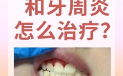 牙龈炎能种牙么