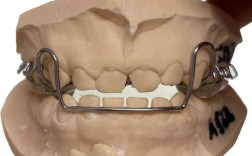 正畸推簧制作的具体步骤是怎样的？不同病例下制作方法有何差异，需注意哪些关键细节？