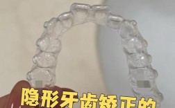 南京牙齿隐形矫正效果如何？适合哪些人？