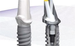 诺贝尔种植牙的特点