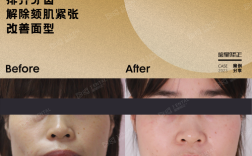 矫正牙齿往里收，对脸型和咬合功能有何影响？