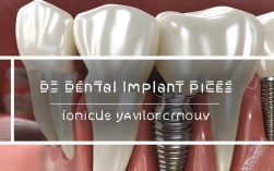 种植牙价格是否包含牙冠费用？