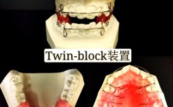 牙齿矫正器怎么选？隐形、金属哪种效果更好又适合自己？