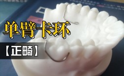 正畸箭头卡环弯制视频，如何掌握正确弯制方法？