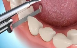 矫正牙齿为何要做片切牙？对牙齿有伤害吗？