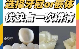 桥冠补牙与种牙有何区别？哪种缺牙修复方式更优？