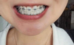 正畸弓丝换太频繁