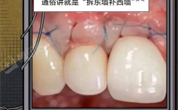 牙齿正畸会让牙根露出