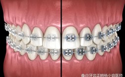 牙齿矫正真的会让牙齿变松动吗？