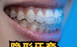 牙齿矫正，钢牙套和隐形到底该怎么选？纠结怎么选才合适？