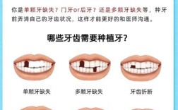 哪个季节种牙好