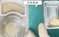 种牙前填充骨粉疼不疼？