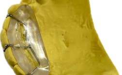 正畸平导的做法视频