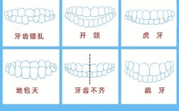 牙齿稀疏矫正要多少钱？价格受哪些因素影响？