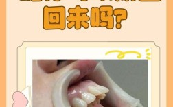 正畸过程中牙齿会龅吗