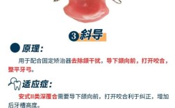 正畸箭头卡弯制步骤如何一步步完成？