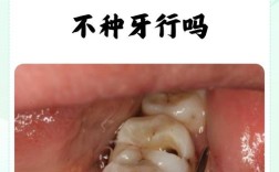 植牙后第二天能吃面条吗？