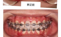 整牙和正畸区别