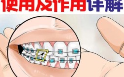 矫正牙齿橡皮筋多久