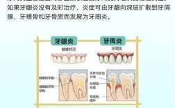 牙周炎的具体治疗方法有哪些？不同严重程度的患者该如何选择针对性方案？治疗期间有哪些注意事项需警惕？