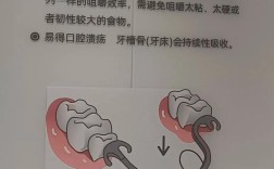 种植牙生物膜固定方法的选择标准、操作步骤及注意事项有哪些？